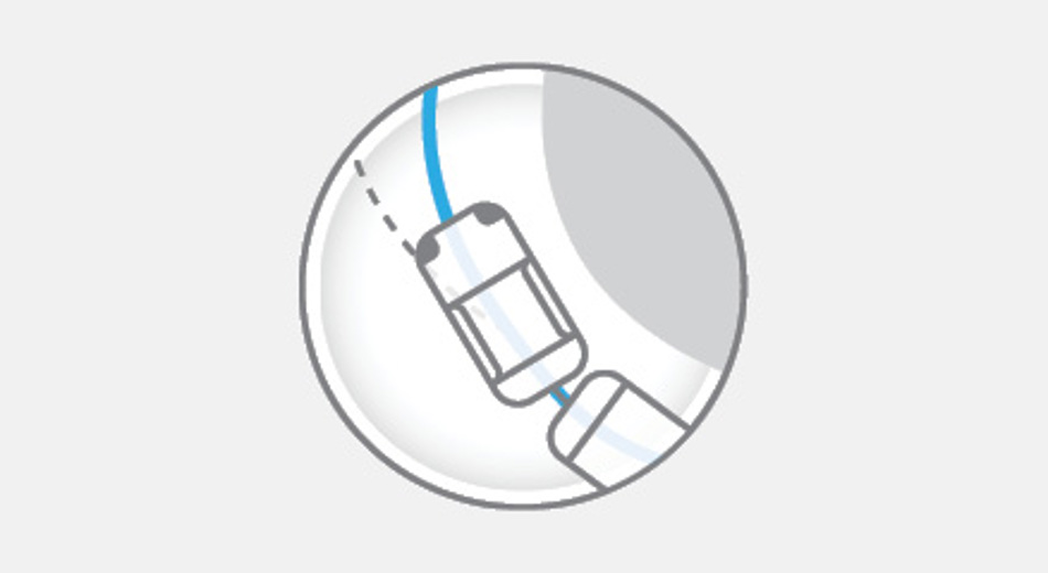 ASSISTANCE AU REMORQUAGE (TSA)*-Vehicule Feature Image